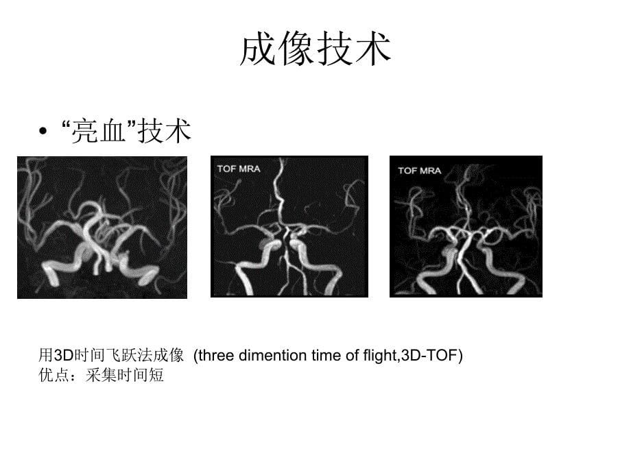 颅内动脉斑块高分辨成像ppt课件_第5页