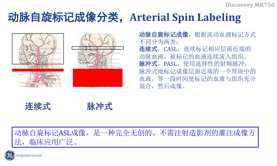 头部asl灌注成像1_第4页