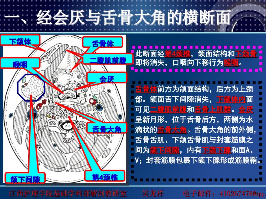 颈部断层解剖第二节颈部横断层解剖最终_第4页