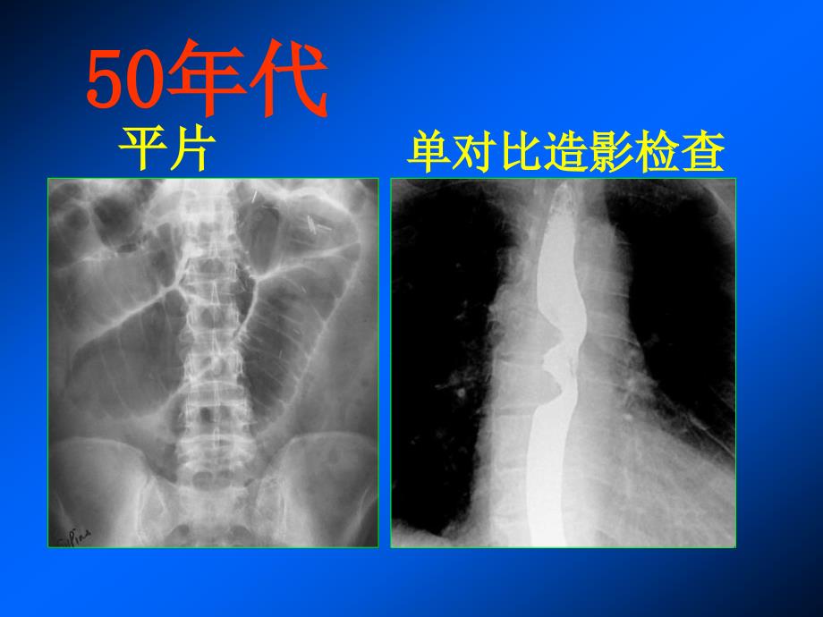 胃肠道影像检查技术的发展_第2页