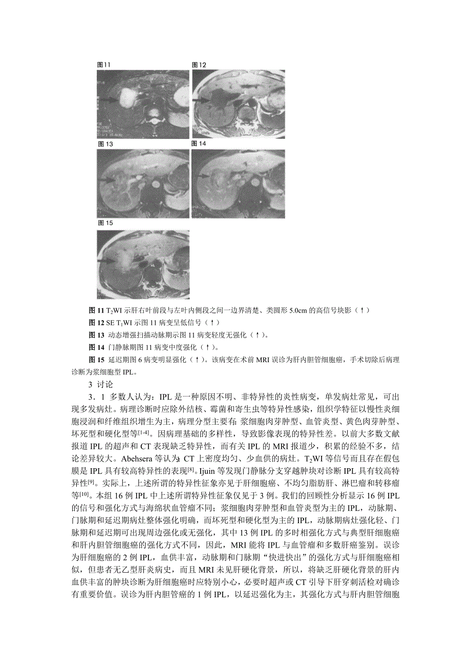 研究论文 肝脏炎性假瘤的磁共振成像诊断_第4页