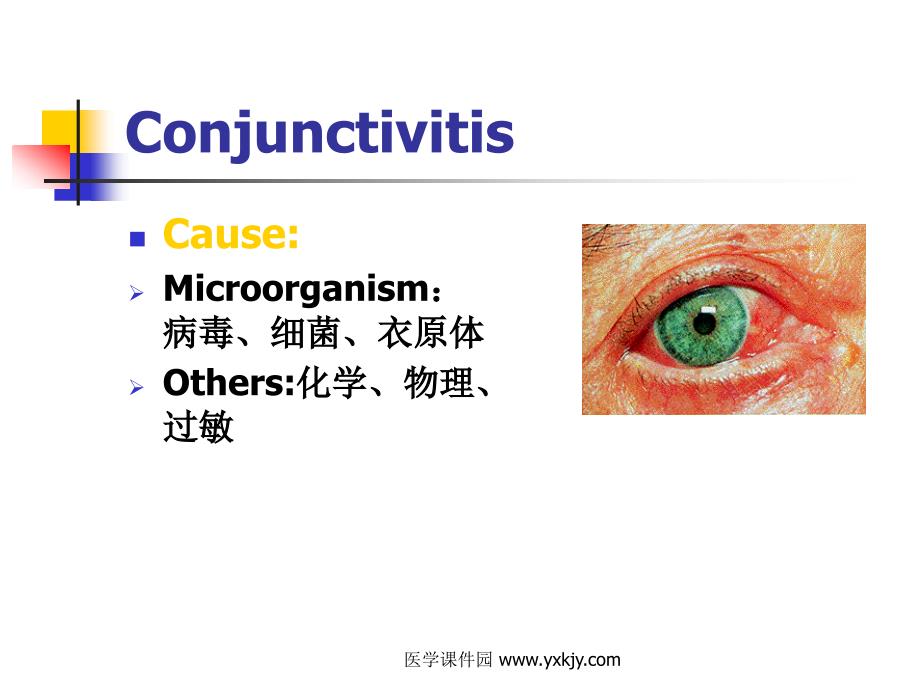 眼结膜疾病--课件_第4页