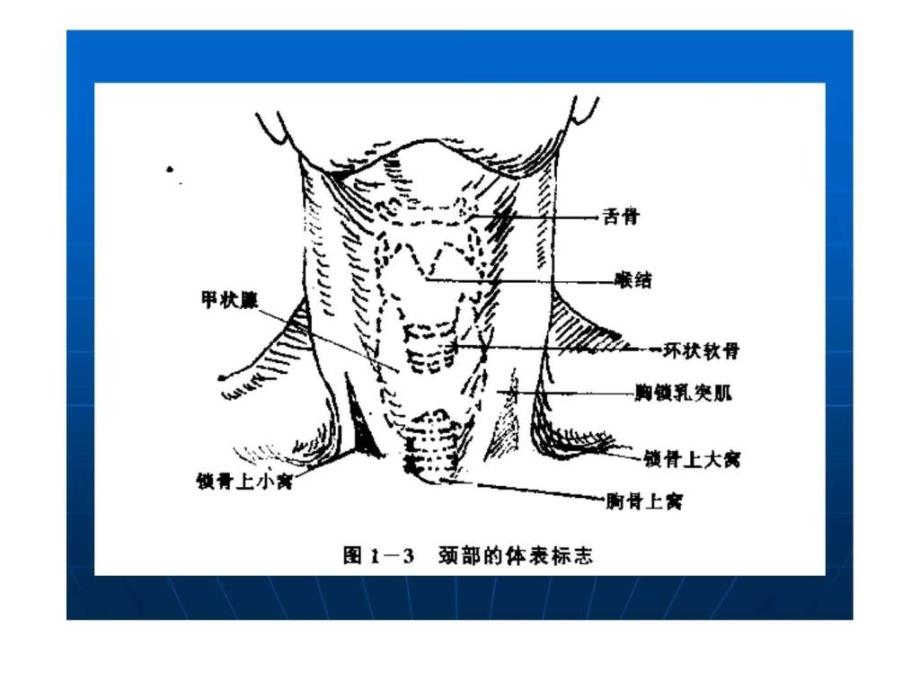 锁骨下静脉穿刺图(1)_第3页