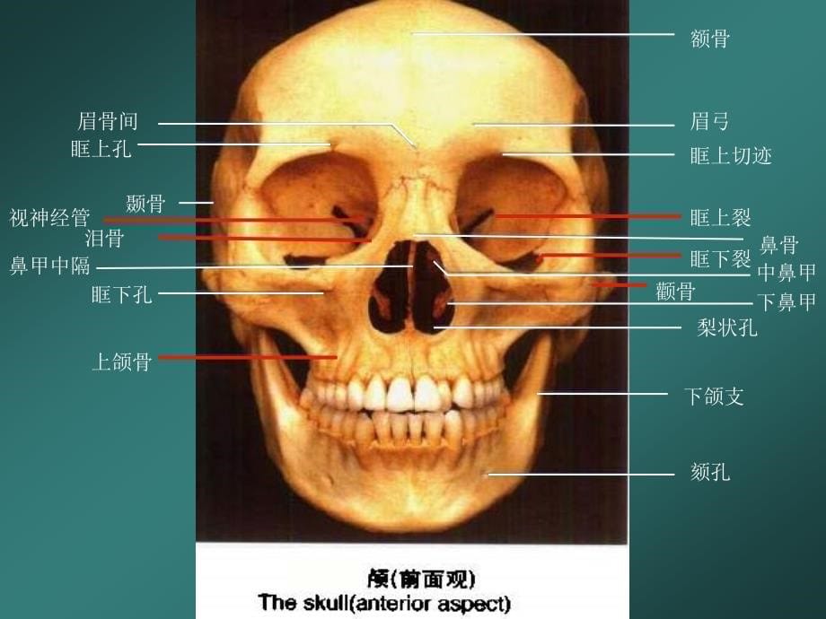 眼及眼眶影像诊断实 oweroint temlate_第5页