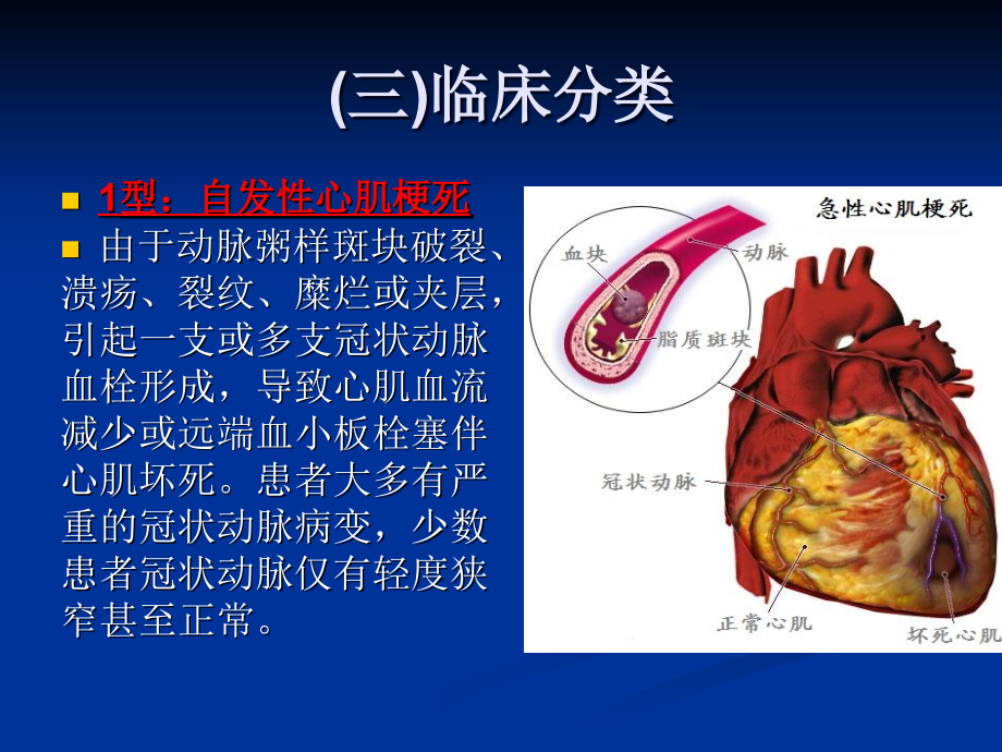 急性st段抬高型心肌梗死诊断和治疗指南(精)_第4页