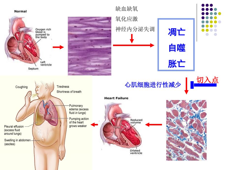 课件：细胞死亡与心衰及中医药干预_第4页