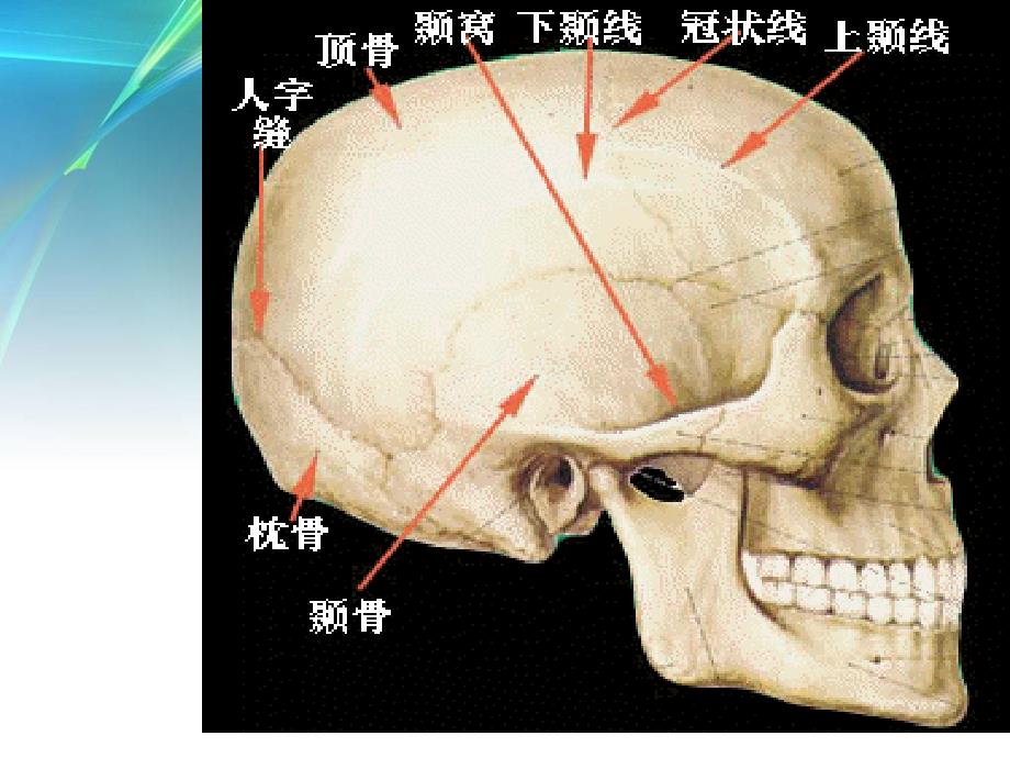 课件：颅骨骨折的规范治疗_第3页