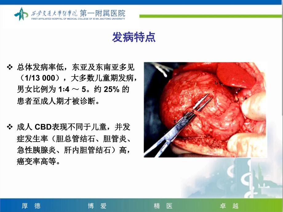 课件：先天性胆管扩张症诊断和治疗要点_第4页