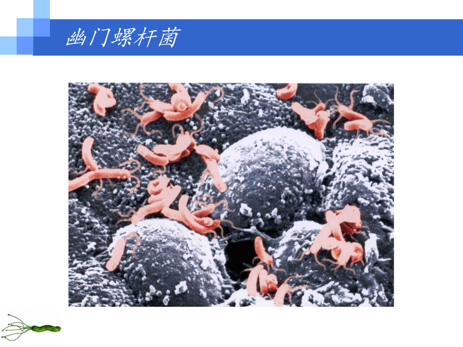 课件：幽门螺杆菌感染诊治的进展_第2页