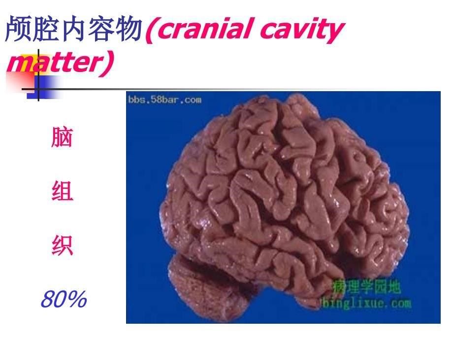 课件：颅内压增高患者的护理常规_第5页