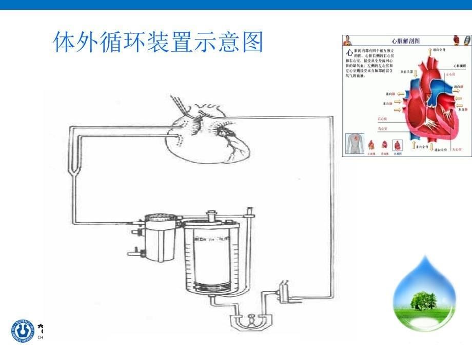 课件：体外循环中医院感染控制_第5页