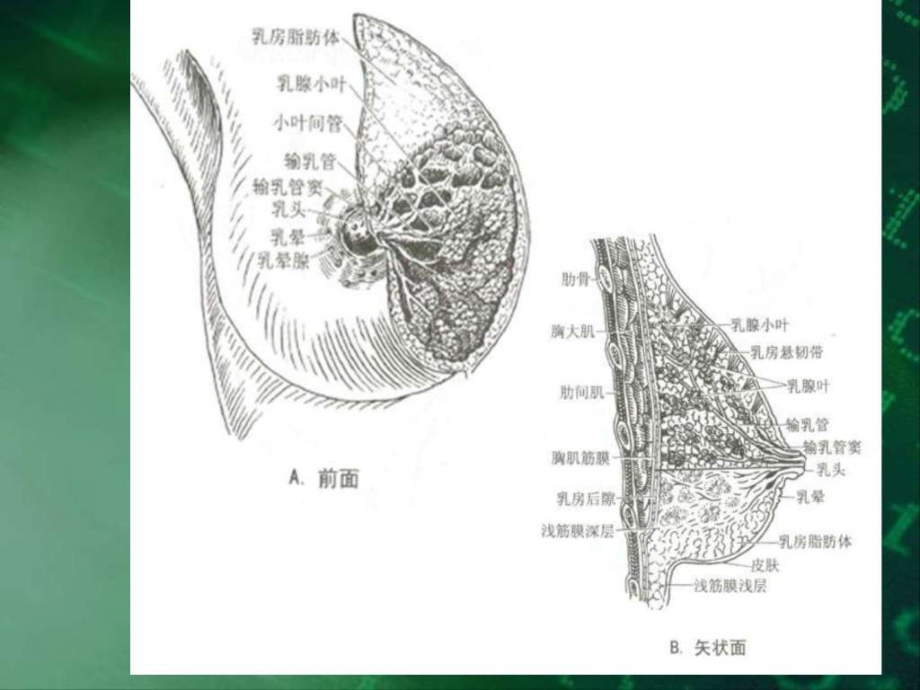 课件：南昌大学超声精品课程之乳腺疾病(1)_第3页