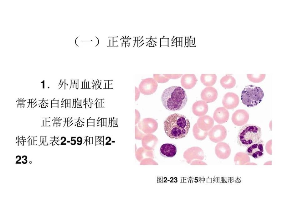 课件：最新 第二章 血液一般检验 04 白细胞部分(中)_第2页