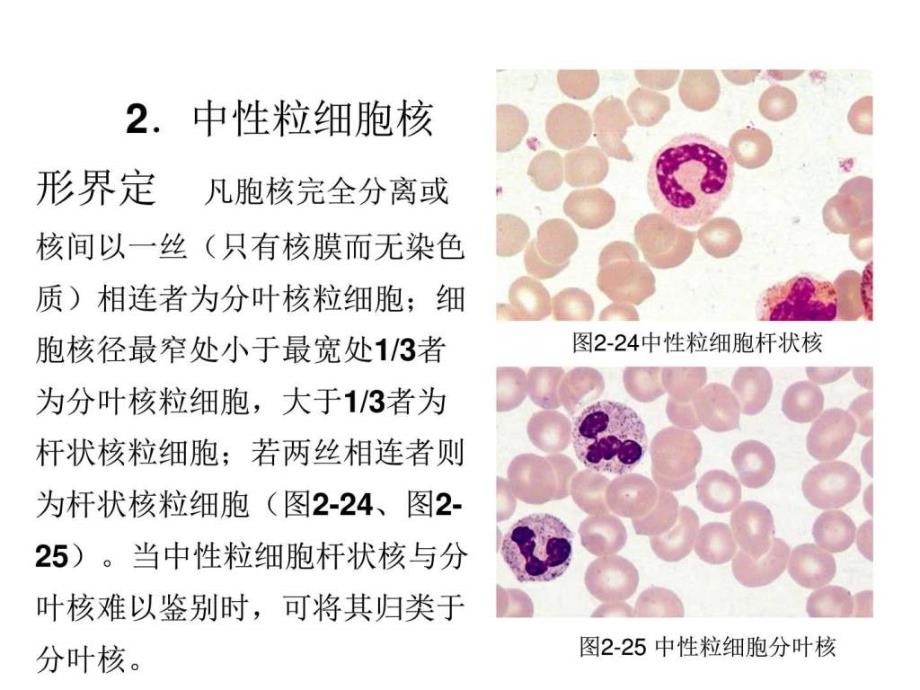 课件：最新 第二章 血液一般检验 04 白细胞部分(中)_第4页