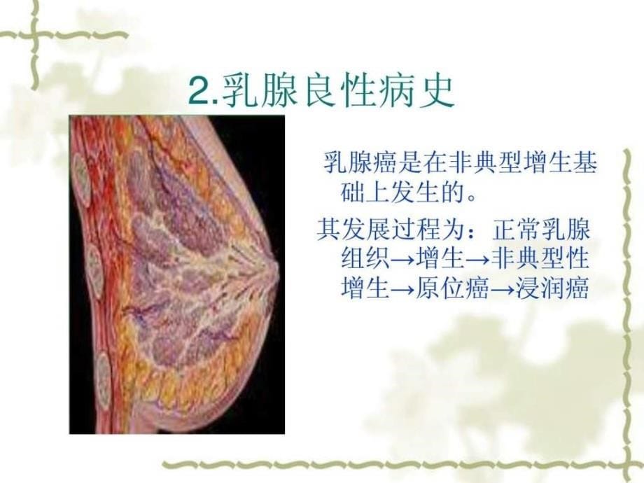 课件：乳腺癌术后患者化疗的护理_第5页