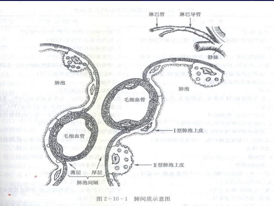 课件：特发性肺纤维化诊断与治疗进展_第5页