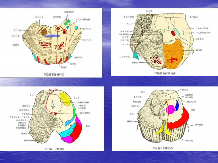 课件：脑干病变的定位诊断_第4页