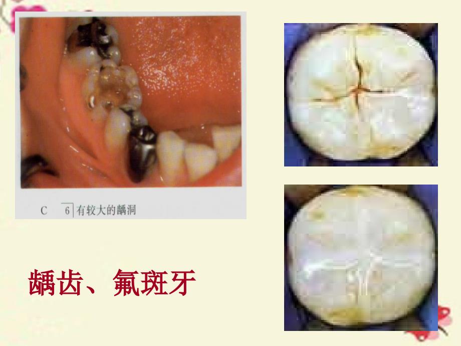 四川省雅安市雨城区中里镇中学九年级化学下册 第十二单元 课题2 元素与人体健康课件1 新人教版_第4页