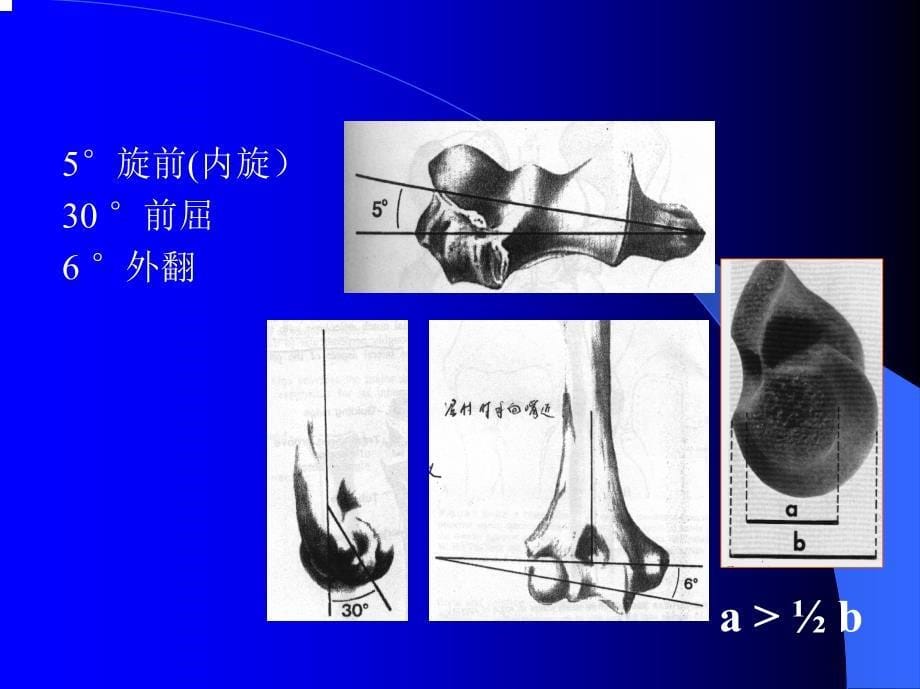 肘关节的解剖与手术入路_第5页