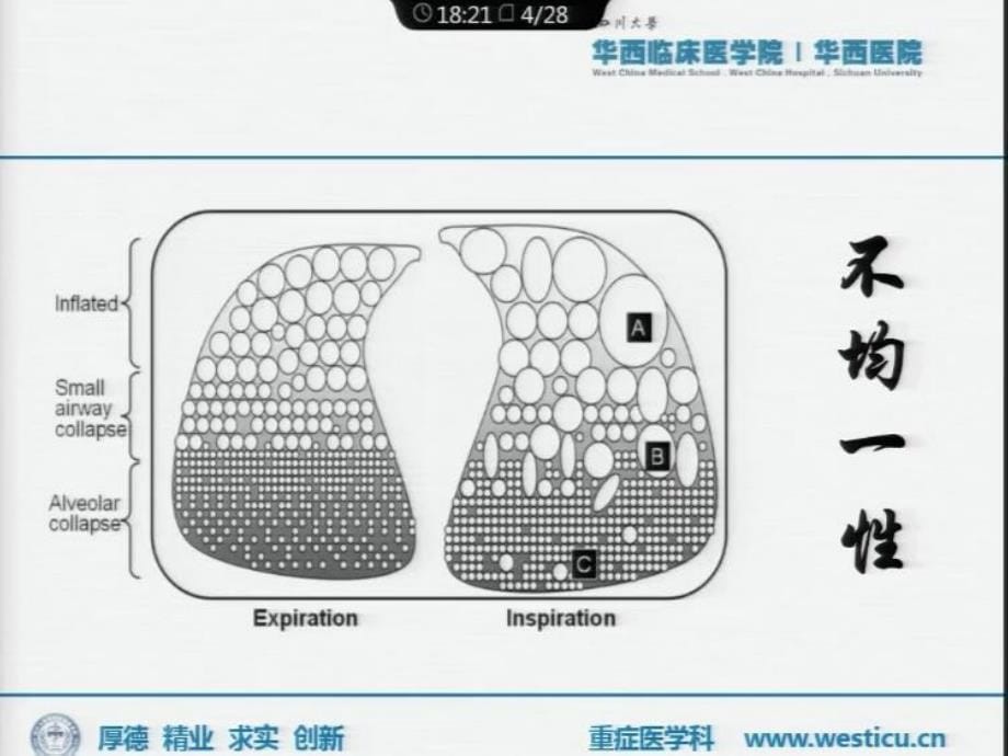 2018重症年会：驱动压_第5页