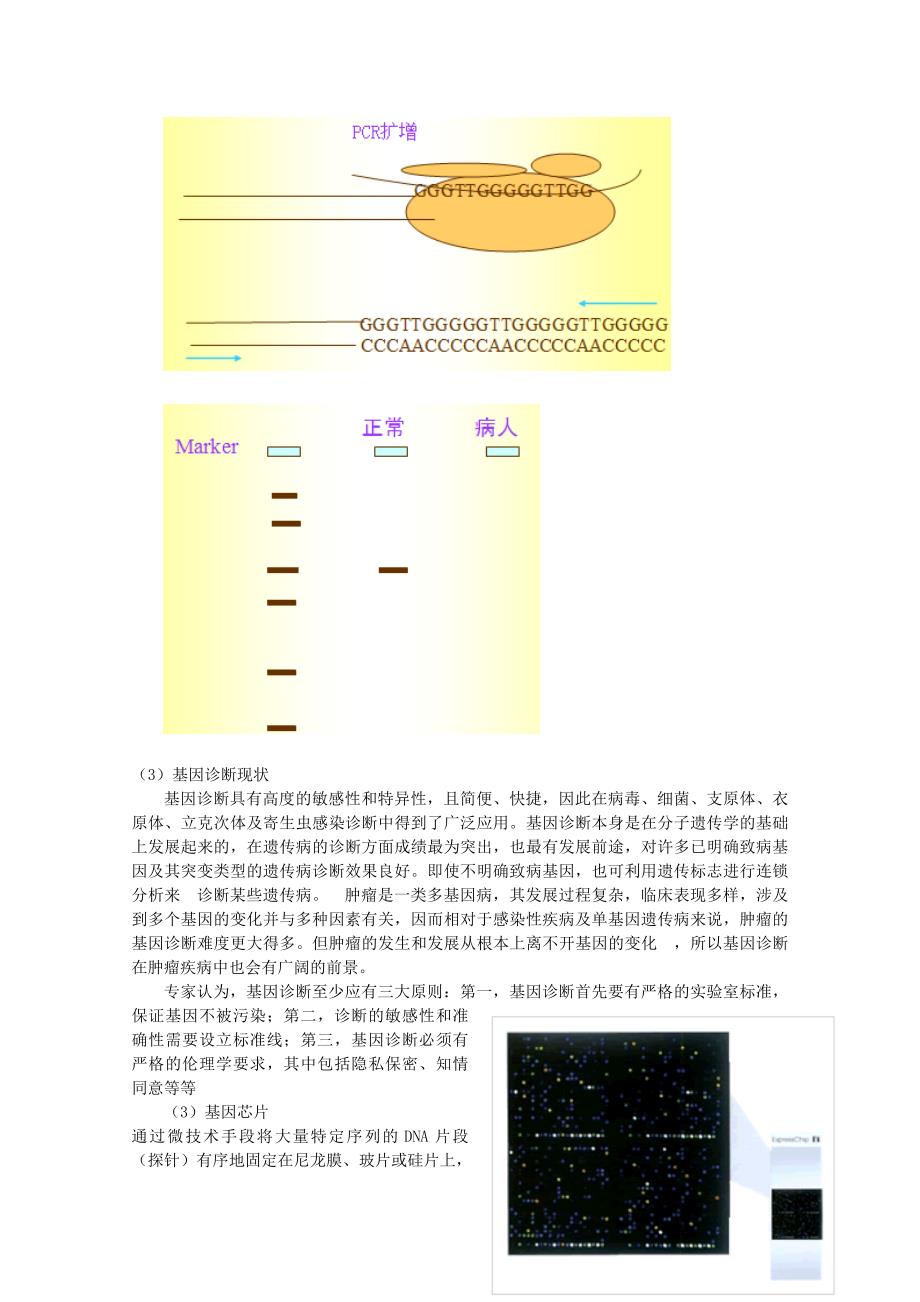 高中生物第三单元生物科学与人类健康第一章疾病的现代诊断与治疗技术3.1.1基因诊断和基因治疗（1）教案中图版选修2_第2页