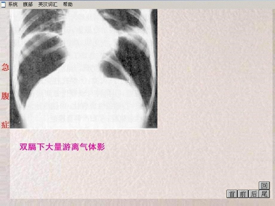 医学课件消化系统诊断与分析_第5页