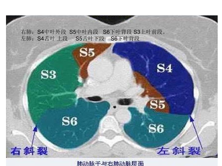 右肺段分叶.ppt_第2页