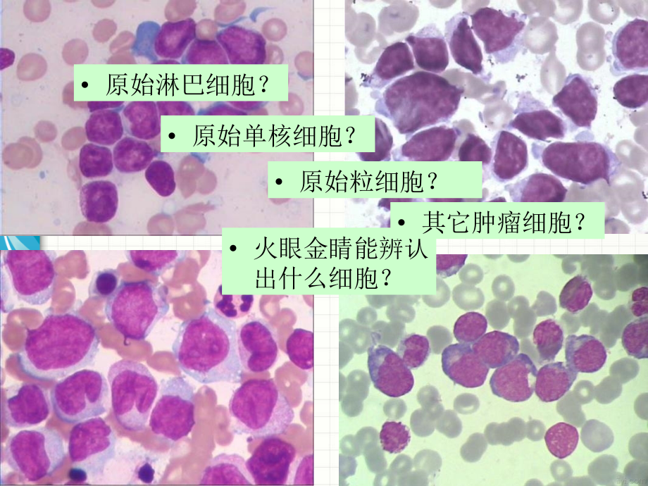 临床血液学检验技术第二节细胞化学染色检验_第3页