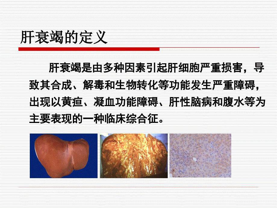 人工肝支持系统（alss)_第2页