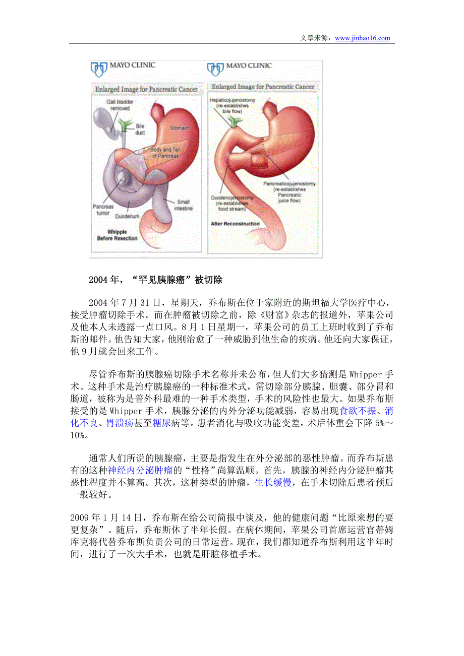 乔布斯与癌症的对抗史_第2页