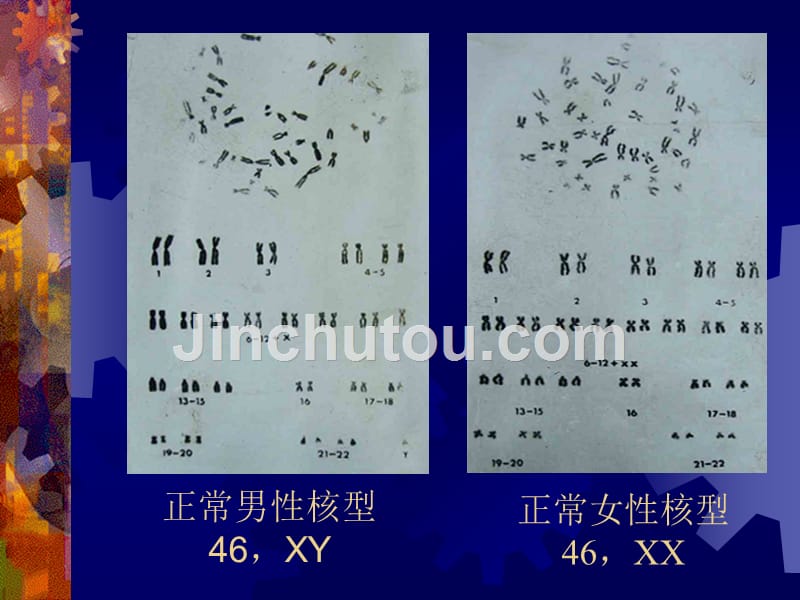 课件：人类染色体畸变及疾病_第3页