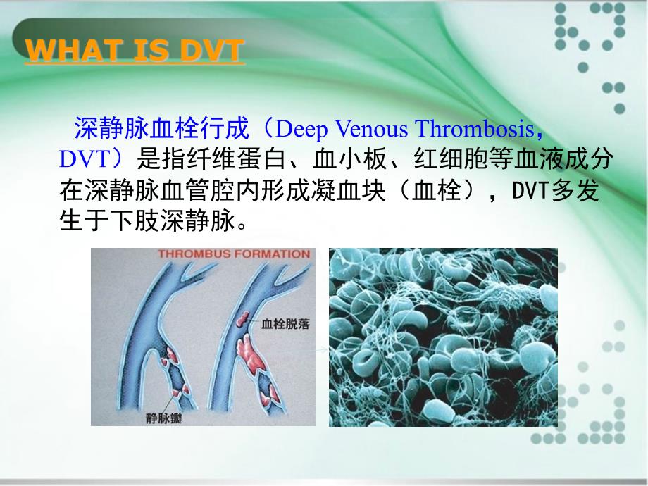 课件：深静脉血栓形成诊治_第2页