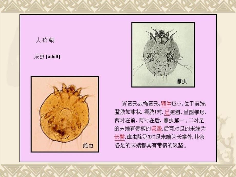 课件：医学节肢动物11临床_第5页