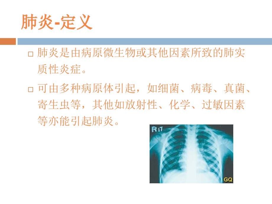 课件：社区获得性肺炎(ca)严重度评价及抗生素的使用_第5页