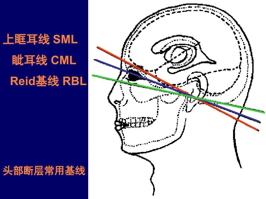 课件：头部断层解剖_第5页