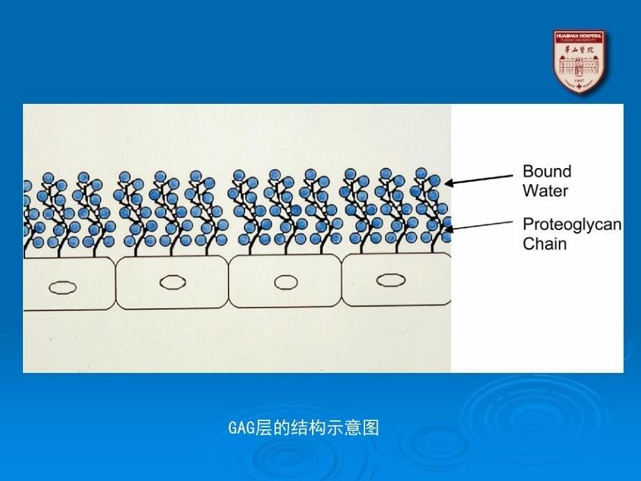 间质性膀胱炎--病因、病理和发病机理_第5页