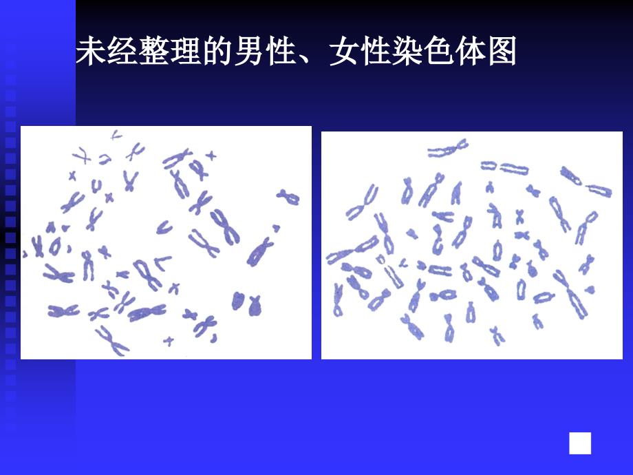 15.3人的性别选择 课件3（苏教版八年级下册）.ppt_第4页