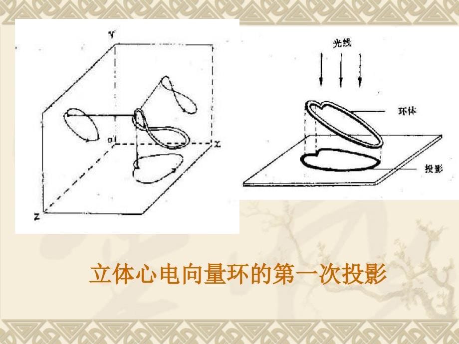 心电图 心电向量详解_第5页