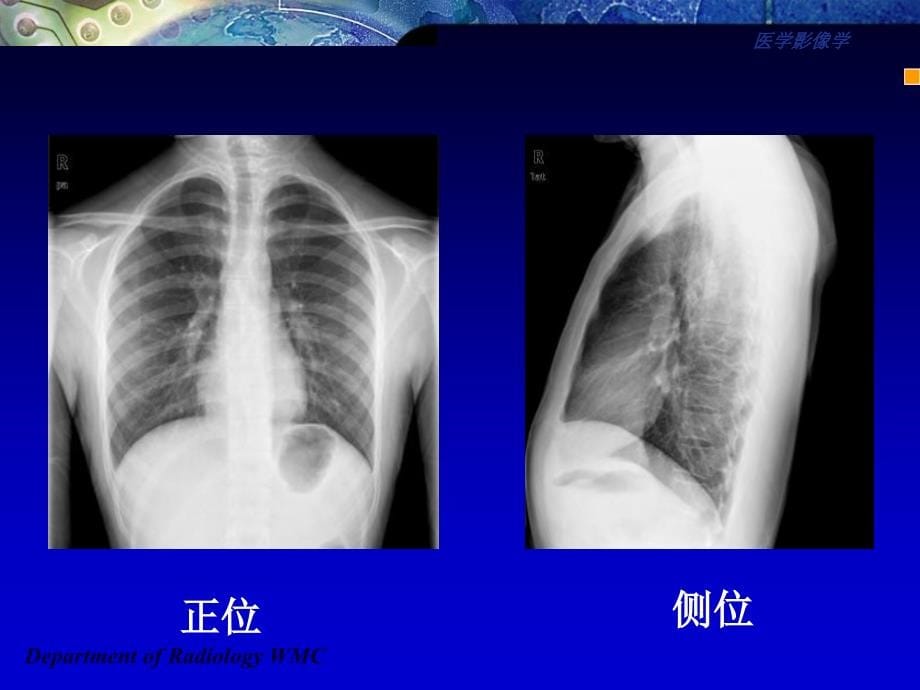 医学影像学(第七版)第四章呼吸系统_第5页