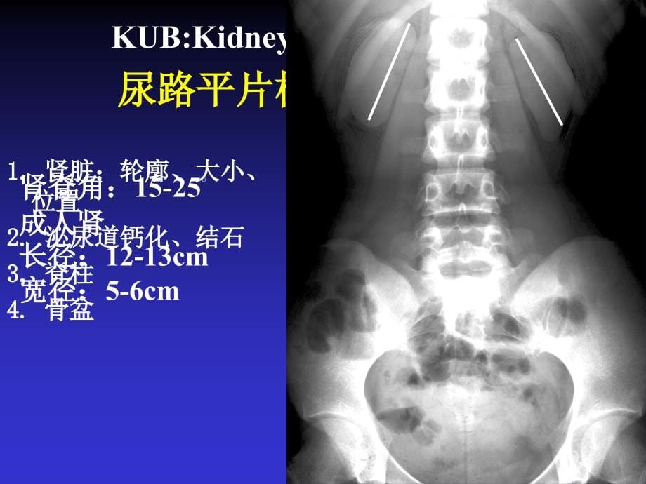 泌尿系统和肾上腺影像学诊断_第5页