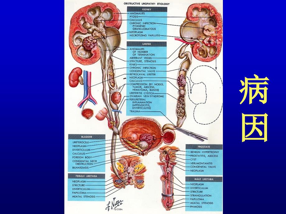 外科学泌尿系统梗阻_第2页