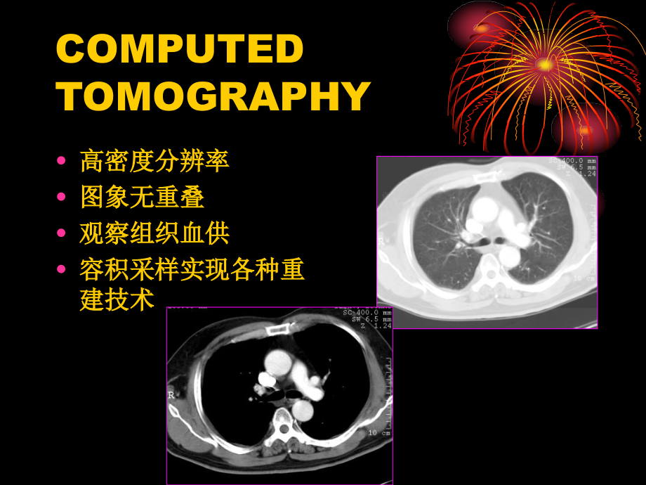 医学影像学肺与纵隔(一)_第4页