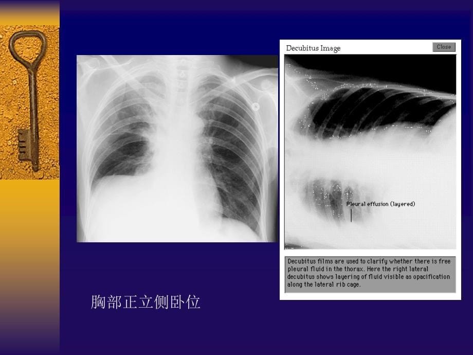 胸部影像诊断学-总论_第5页