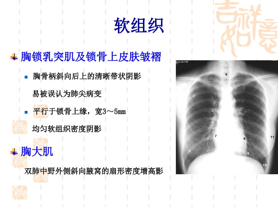 放射科胸部正常与基本病变_第3页