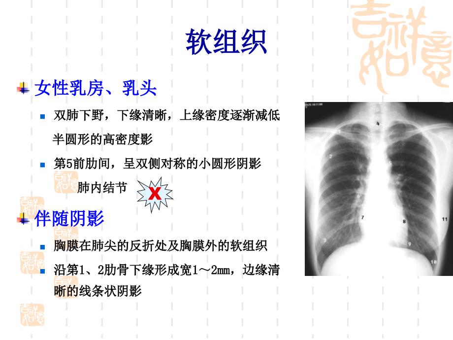 放射科胸部正常与基本病变_第4页