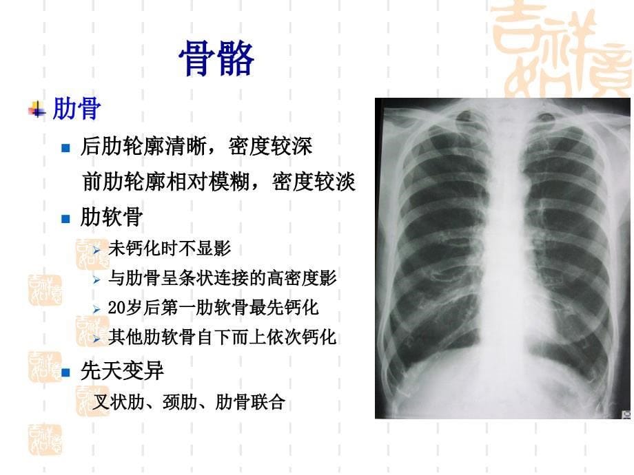放射科胸部正常与基本病变_第5页