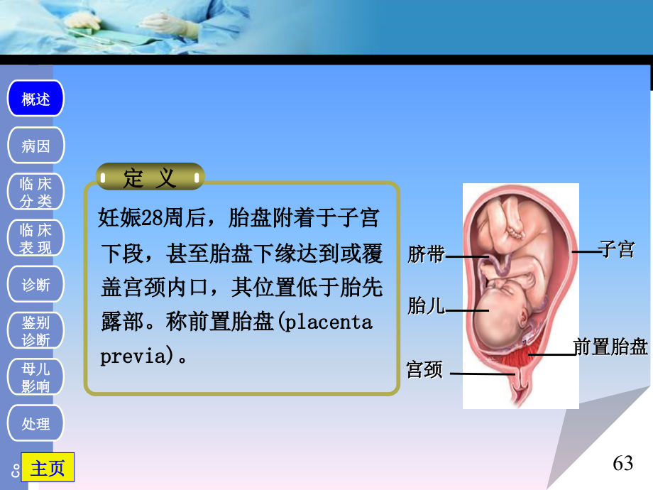 前置胎盘1概述_第3页