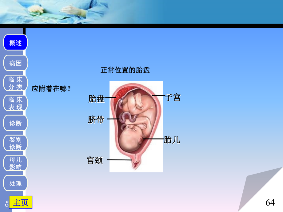 前置胎盘1概述_第4页