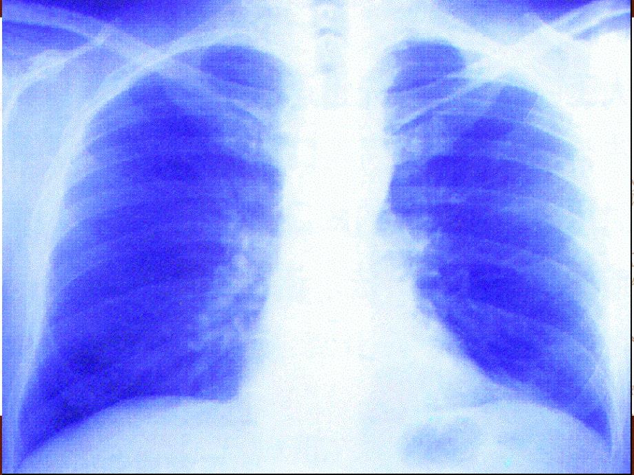 发生在肺内的气体交换_16_第3页