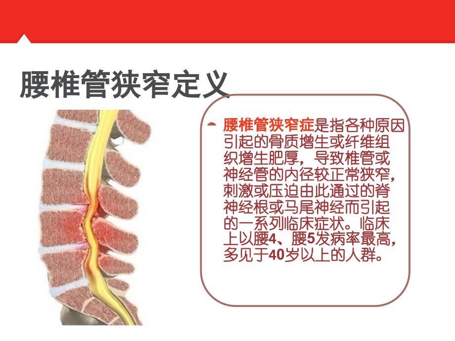 老年性腰椎管狭窄围手术期护理_第3页